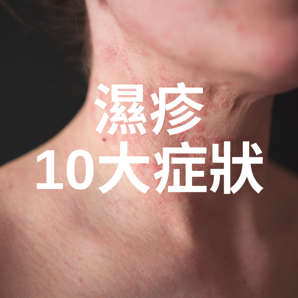 濕疹 10 大常見症狀與識別方法：從紅腫癢到肌膚重生的全攻略