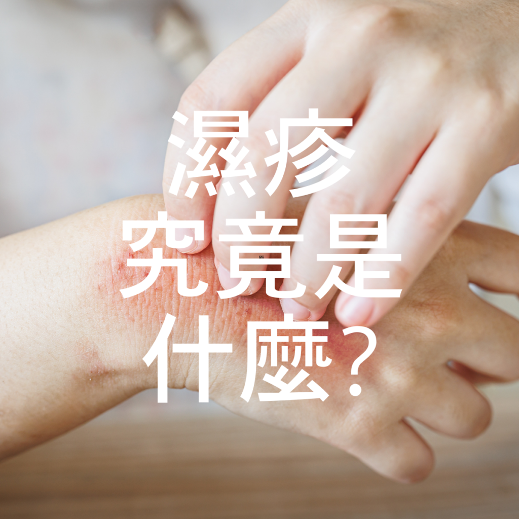 濕疹是什麼？新戰友必讀指南